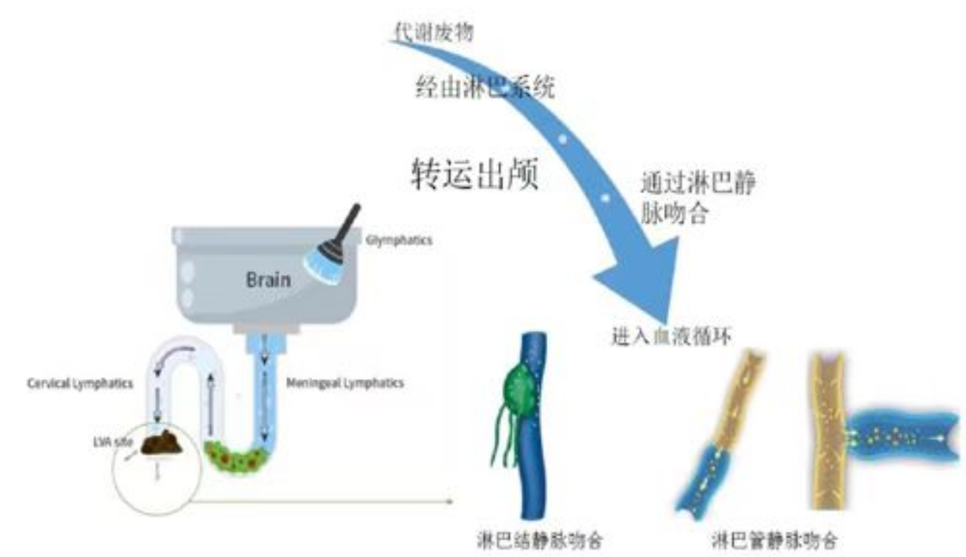 重磅喜讯！常德市第一人民医院开展湘西北首例颈深淋巴—静脉吻合术治疗阿尔兹海默症