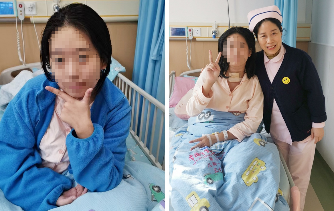 15岁女孩突发癫痫生命垂危，常德市第一人民医院2个多月精心救治跑赢“死神”