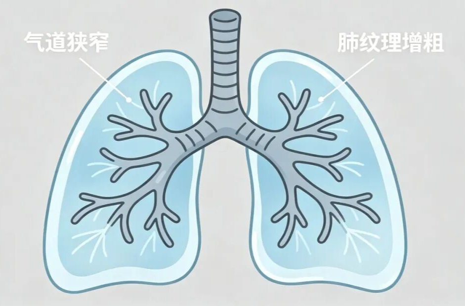 【健康科普】慢阻肺：被忽视的“沉默杀手”，这些信号千万别漏