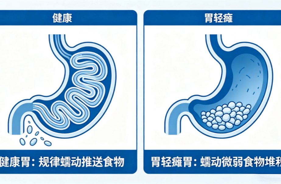 【健康科普】你的胃“罢工”了？别把胃病不当病！